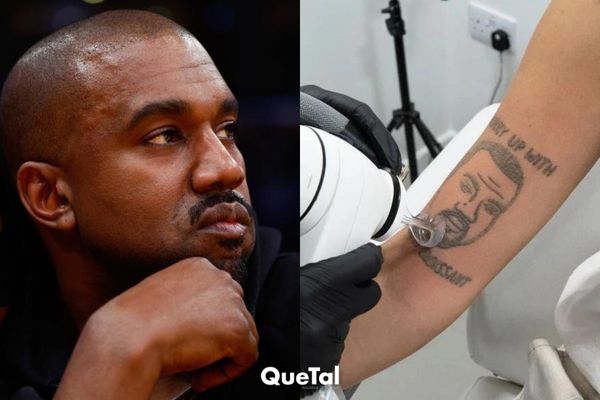 Un estudio ofrece quitar tatuajes de Kanye West gratis